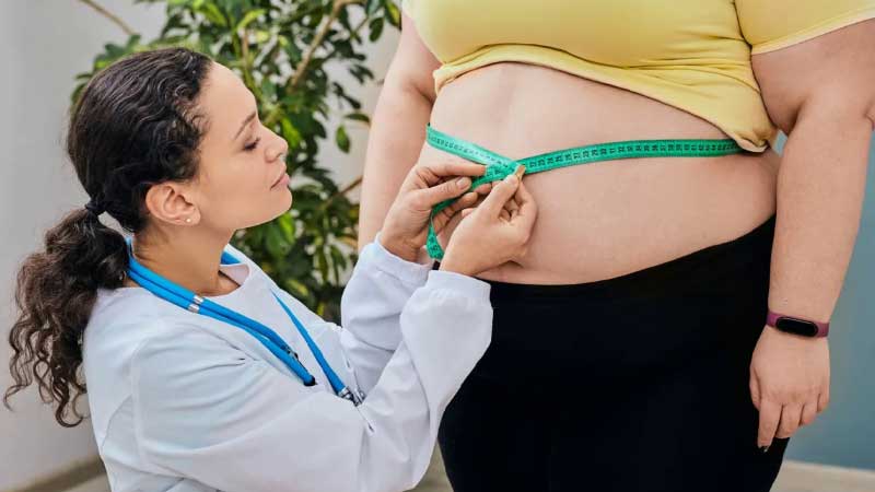 Các mức độ của bệnh béo phì được xác định dựa trên chỉ số khối cơ thể (BMI)